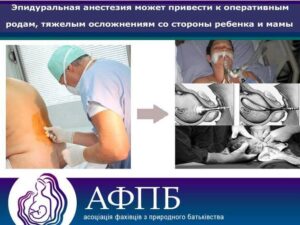 Read more about the article Почему у эпидуральной анестезии нет показаний?